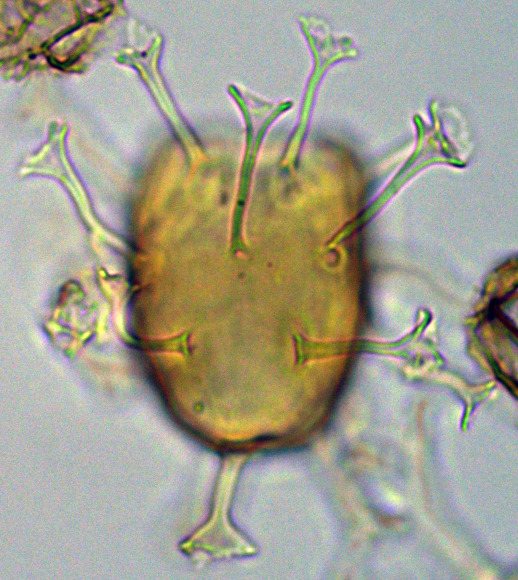 Hystrichosphaeridium tubiferum 2 Htub27X23334295a.jpg